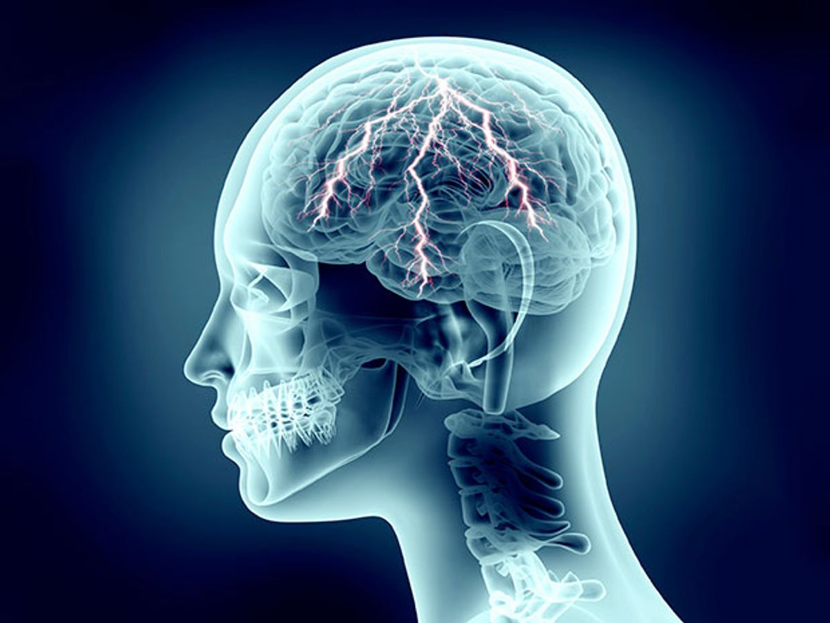 插图显示大脑受到电流刺激。