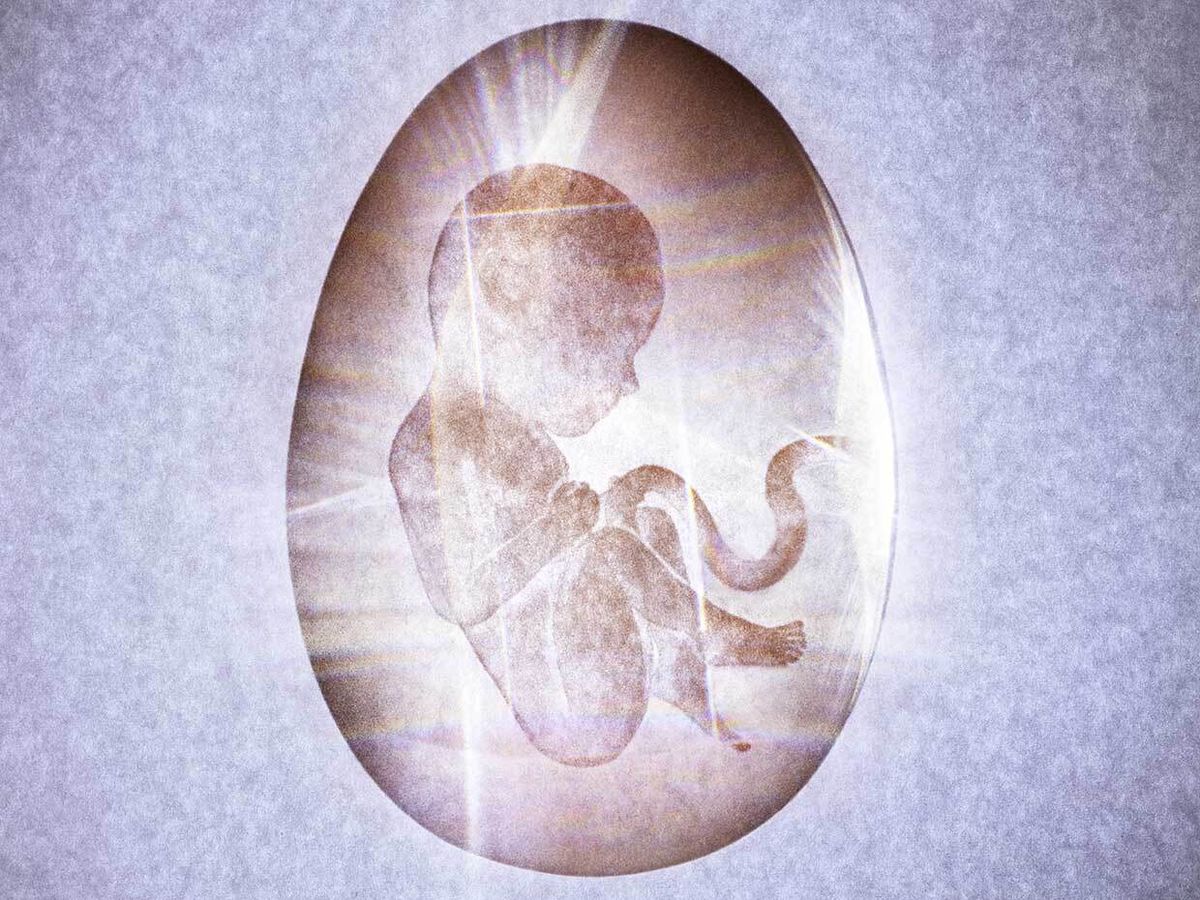 一个早产婴儿在人工子宫的概念照片。